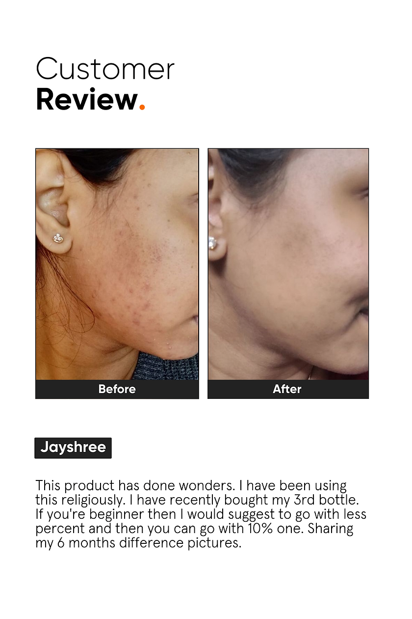 Minimalist Niacinamide 10% Face Serum