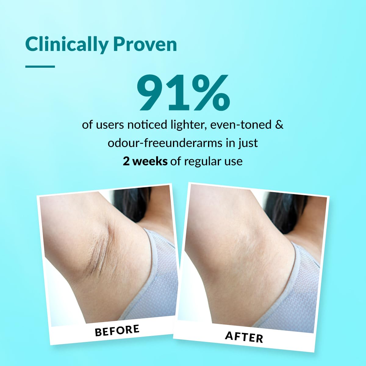 FIXDERMA Nigrifix Underarm Roll On With 6% AHA, Lactic Acid & 1% Mandelic Acid & Kojic Acid | Brightens Skin & Exfoliates Underarm | For Sensitive Skin - 60Ml (Pack Of 2), For Unisex