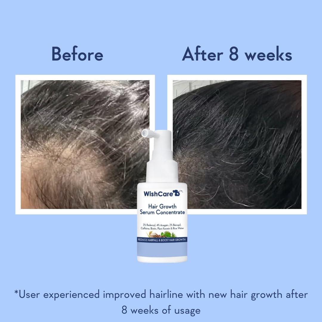WishCare Hair Growth Serum Concentrate - 3% Redensyl, 4% Anagain, 2% Baicapil, Caffeine, Biotin, Plant Keratin & Rice Water - Hair Growth Serum For Men & Women, 30ml