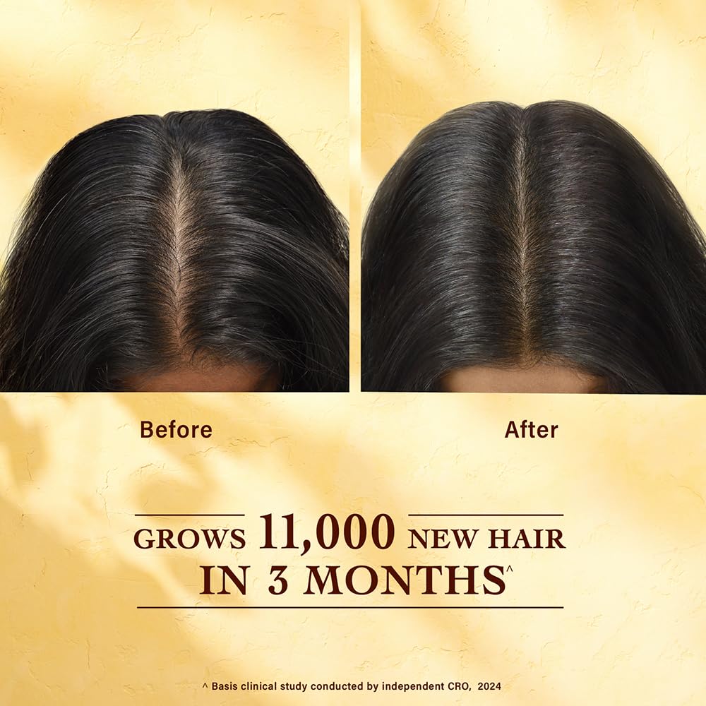 Indulekha Bringha Hair Growth Treatment Scalp Serum ,30ml |Ayurvedic Hair Growth Serum