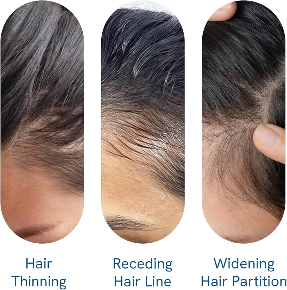 Be Bodywise Rosemary Hair Growth Serum (Roll On) 25Ml