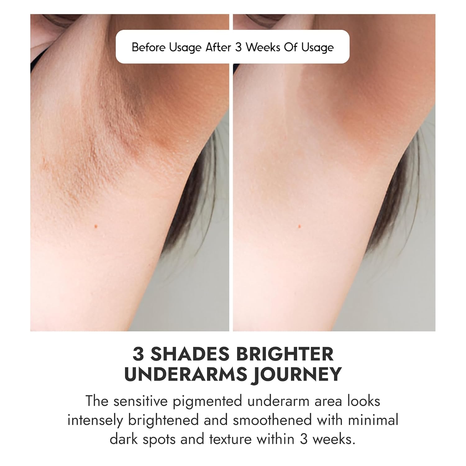 Cos-IQ Brightening Underarm Roll-On Serum for Women, 80ml | With Bioecolea, Mandelic Acid and Bio White | Prevents Body Odour, Brightens Skin & Exfoliates Underarms | 60 Days Pack