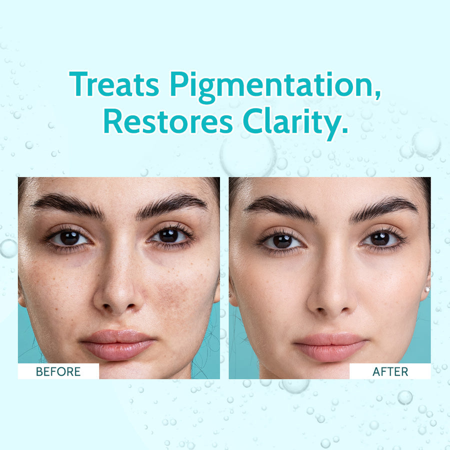 Chemist At Play's Clarifying Serum | 10% Niacinamide 30Ml