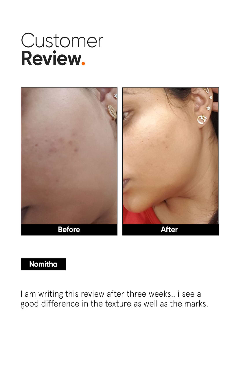 Minimalist AHA PHA BHA 32% Face Peel 30ML
