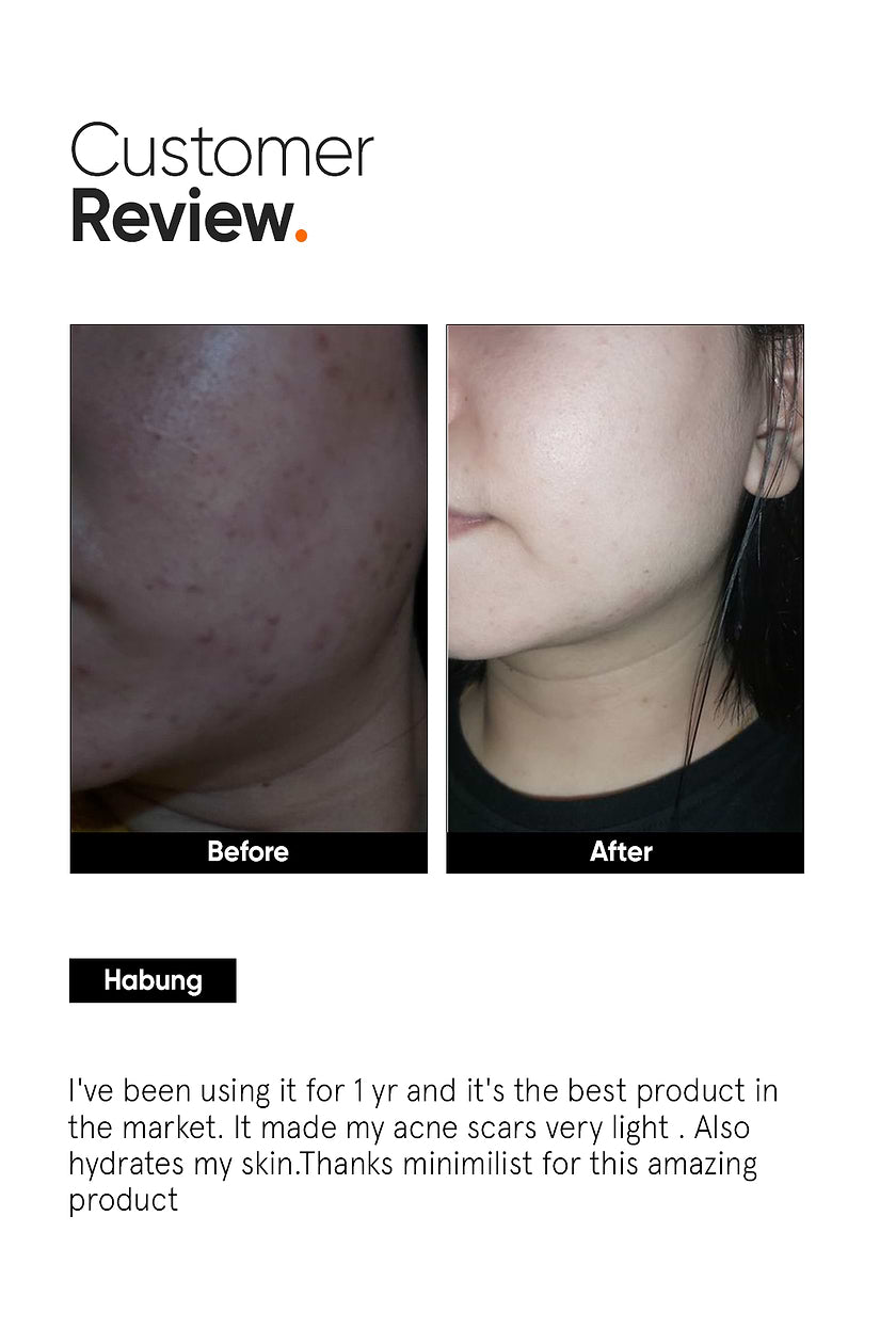 Minimalist Alpha Arbutin 2% Face Serum 30ML