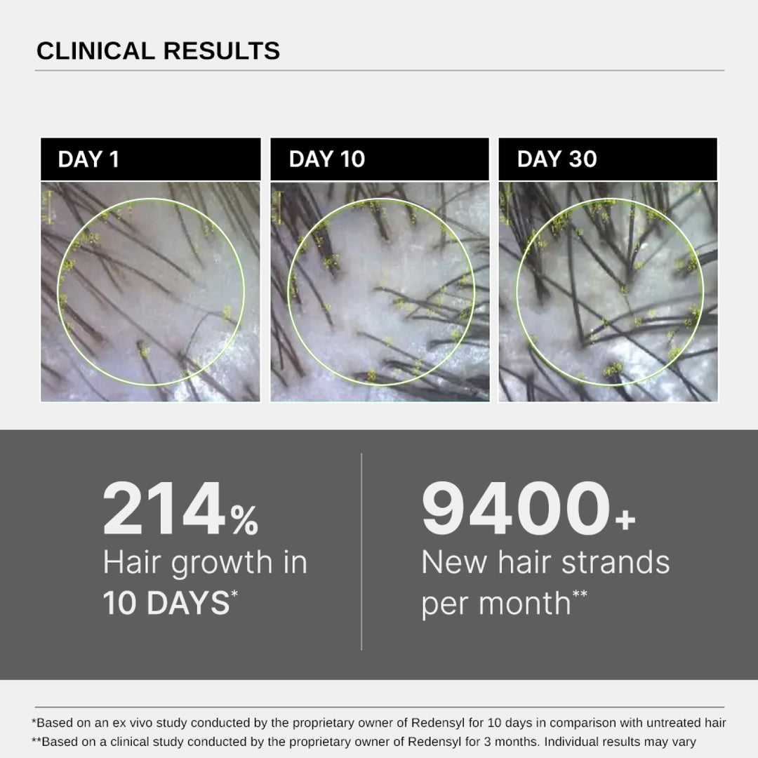 Bare Anatomy Advanced Hair Growth Serum with Redensyl, Rosemary, Rice Water (30 ml)